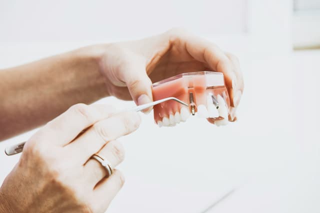 dental implant treatment in birmingham