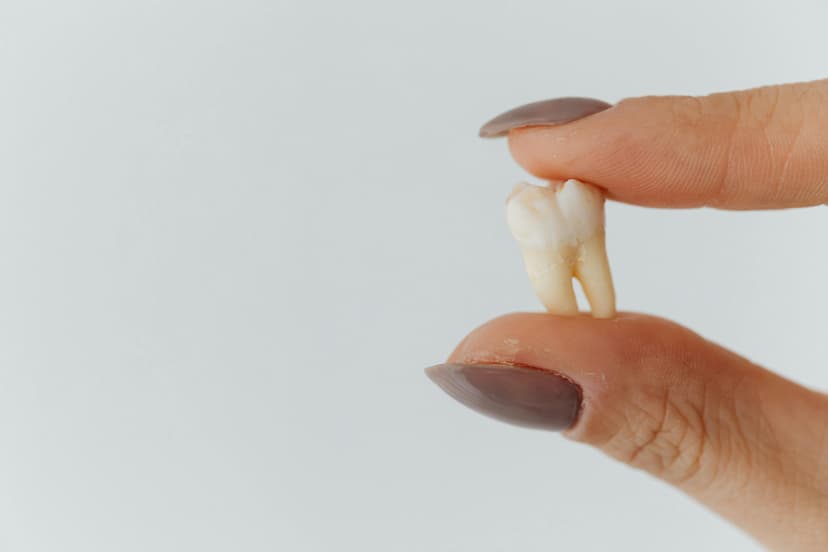wisdom tooth extraction birmingham